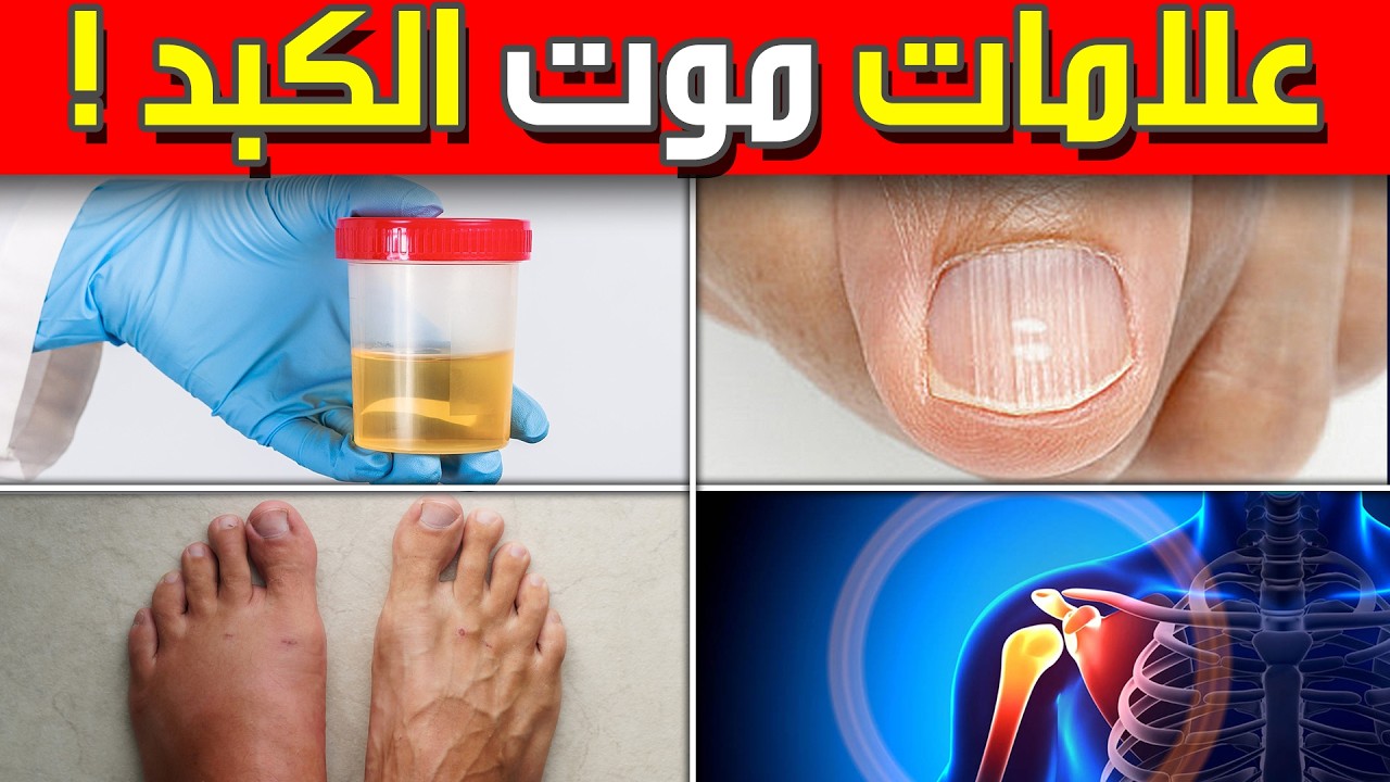 احذر: 10 علامات ان كبدك يموت (و العلاج الطبيعي الجبار!)