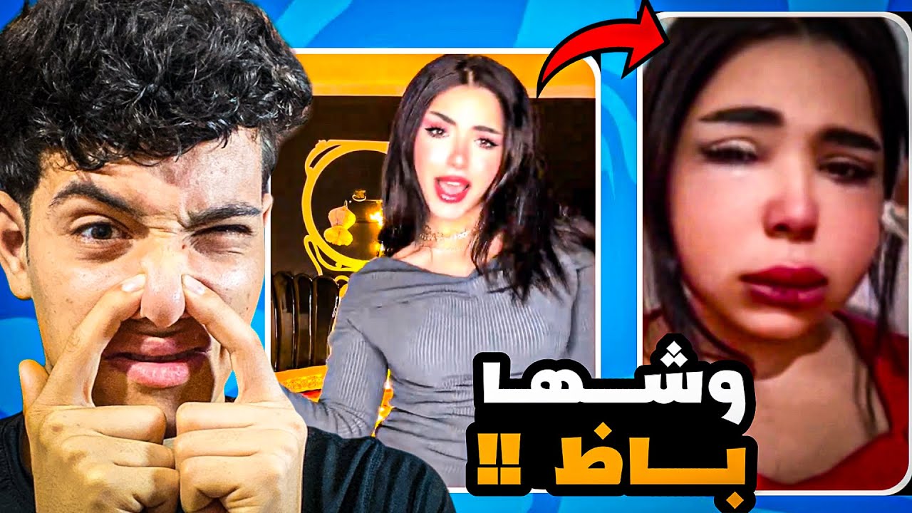 هاجر سليم وشها باظ بسبب الحقن 😨 ( اي حصلها ) !!