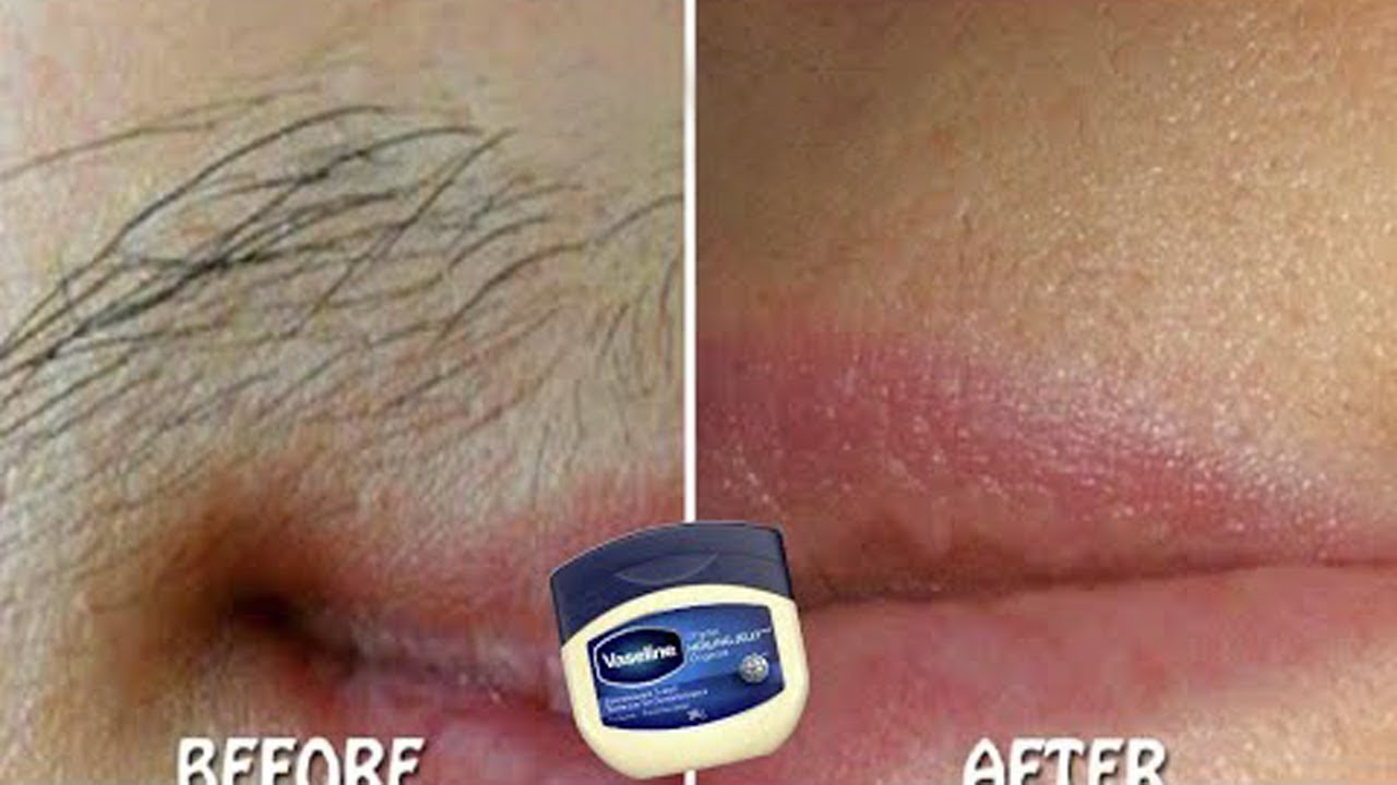 How to use Vaseline to permanently get rid of unwanted hair on the face and body.