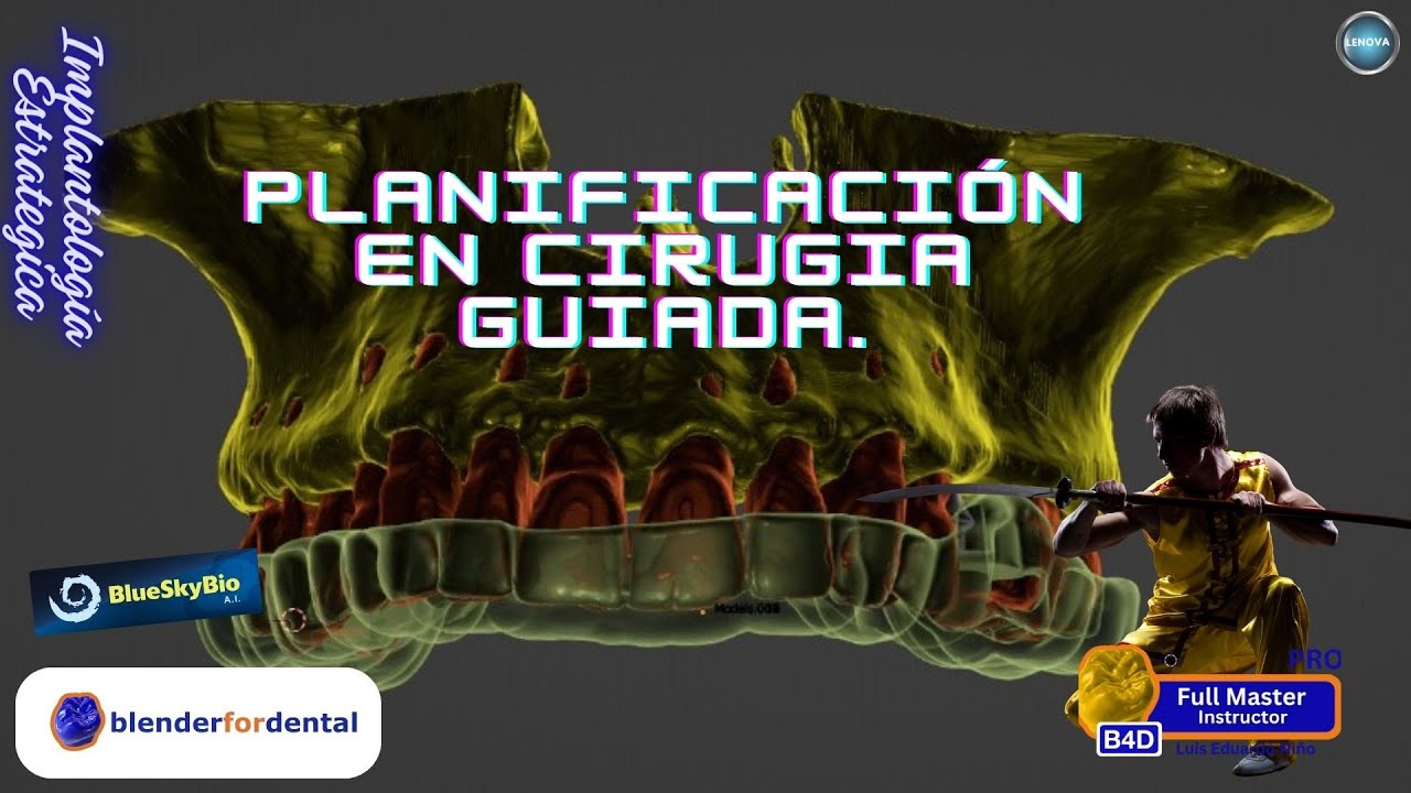 Guía Completa para la Planificación de Implantes en Odontología Digital 😎 Planificación estratégica🛩