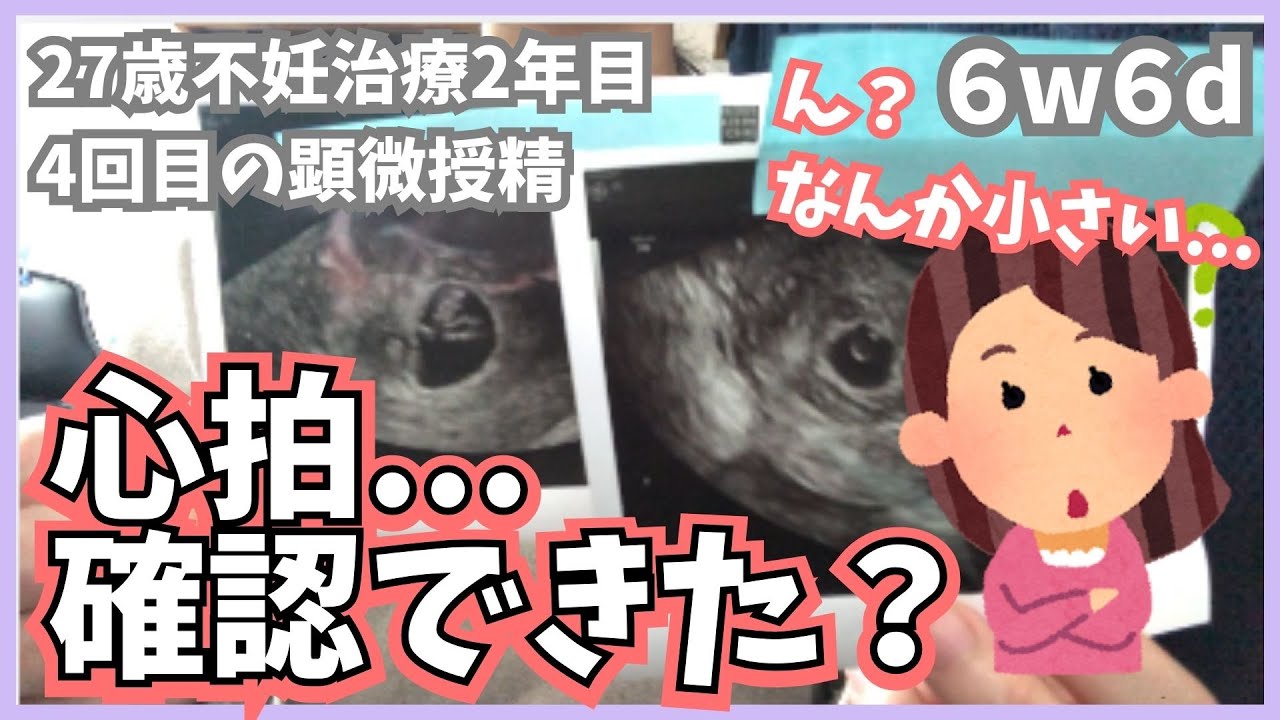 【心拍確認】妊娠6週6日｜妊娠判定後2回目の診察で見えたもの#不妊治療vlog #不妊治療 #体外受精 #妊活