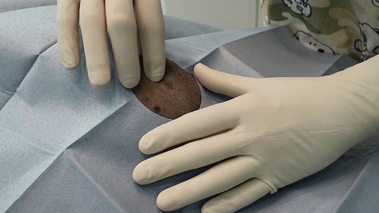 Epidural anaesthesia in the dog