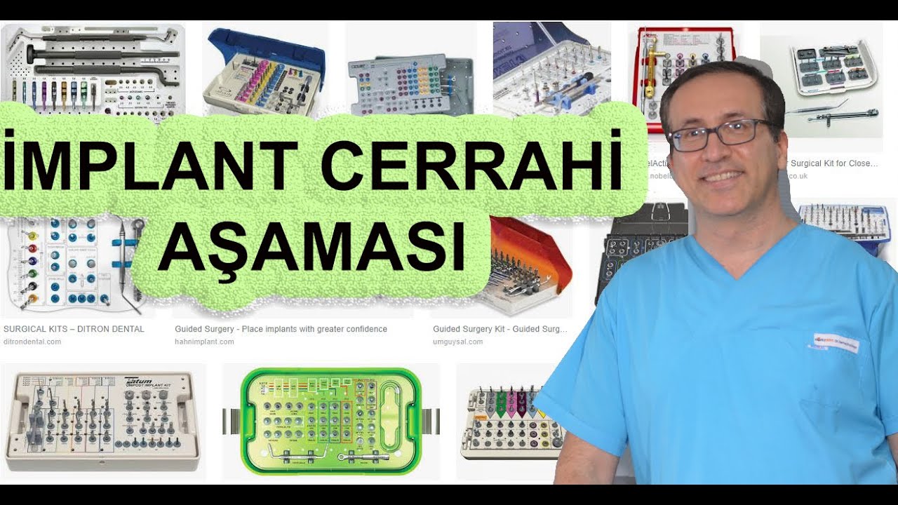 İmplant yapımı ve cerrahi aşama! İyi planlama, iyi uygulama ve iyi bakım gerekiyor. İstanbul Diş