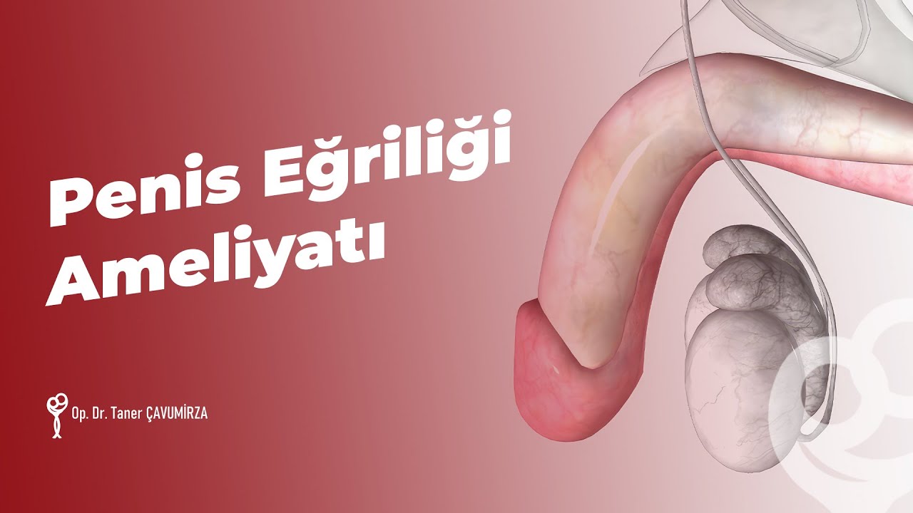 Penis Eğriliği Ameliyatı