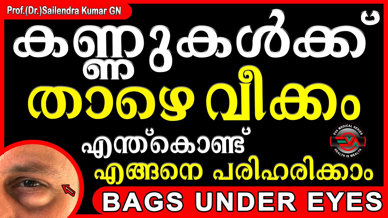 BAGS UNDER EYES | കണ്ണുകൾക്ക് താഴെ ഉണ്ടാകുന്ന ബാഗുപോലുള്ള വീക്കം എന്ത് കൊണ്ട് | എങ്ങനെ പരിഹരിക്കാം