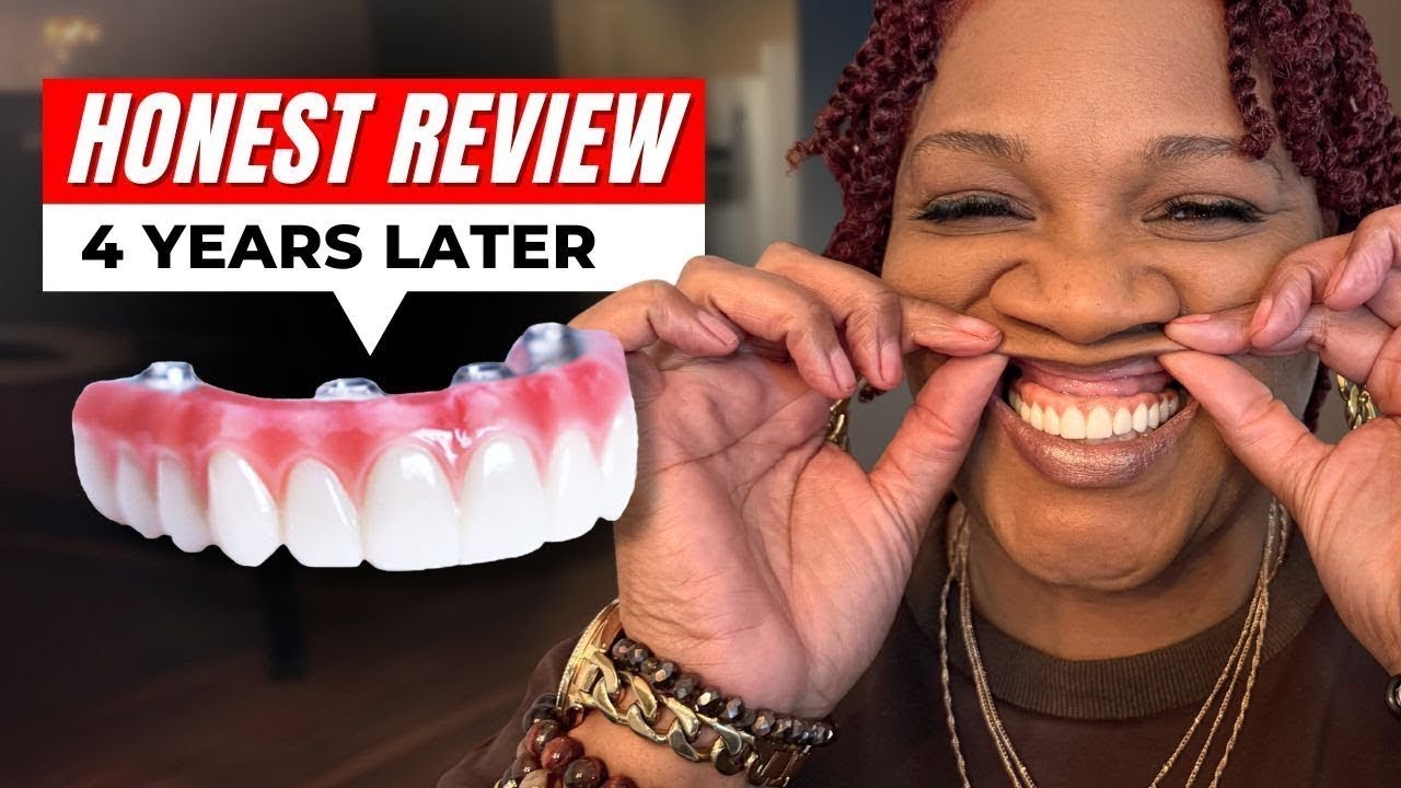 Are My Dental Implants Still Worth It After 4 Years? My Pros & Cons