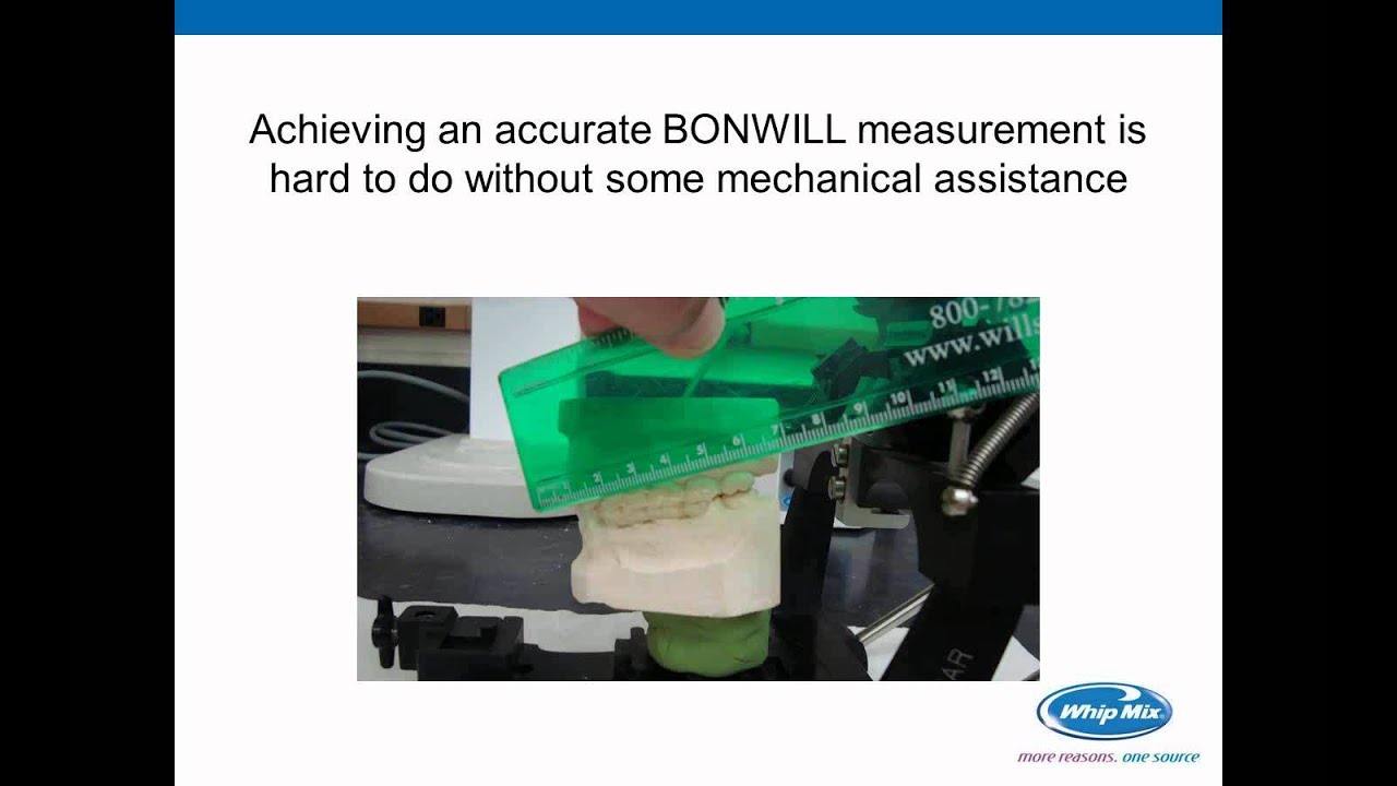 [Webinar] Arbitrary Mounting to Large Frame Articulators with Craig Pickett, CDT, RG, TE