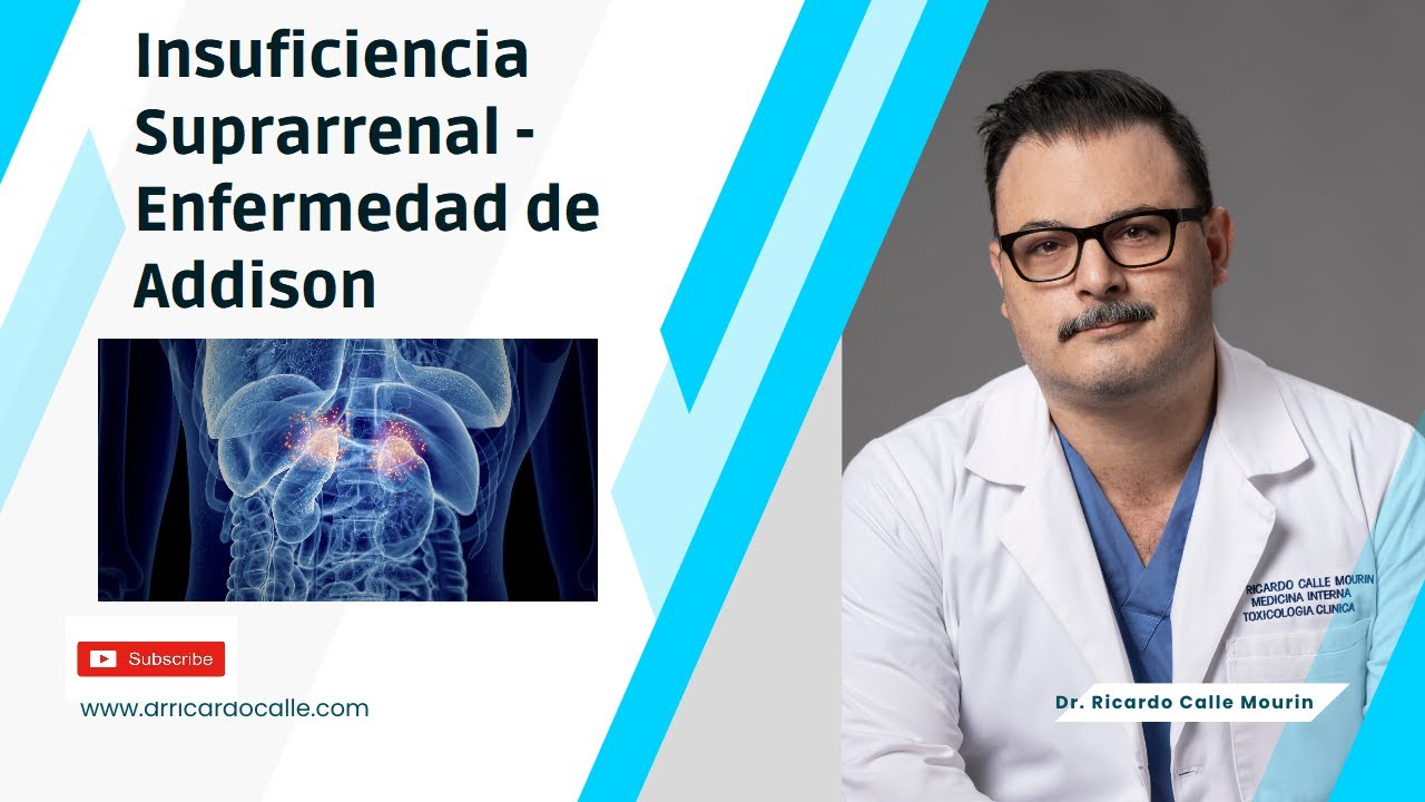 Insuficiencia Suprarrenal | Enfermedad de Addison. Síntomas y Signos