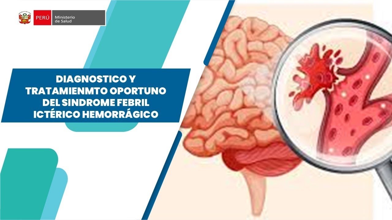 DIAGNÓSTICO TRATAMIENTO OPORTUNO DEL SÍNDROME FÉBRIL ICTÉRICO HEMORRÁGICO