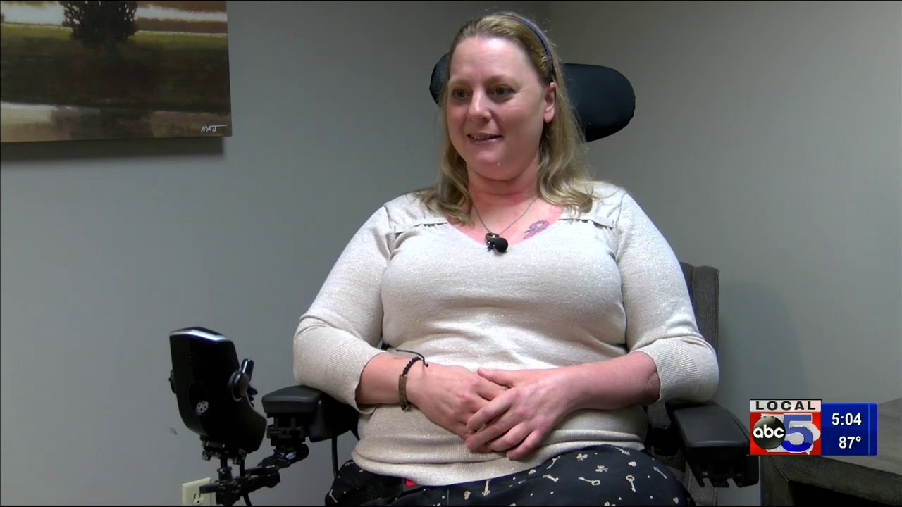 Double leg amputee speaks out on freak accident