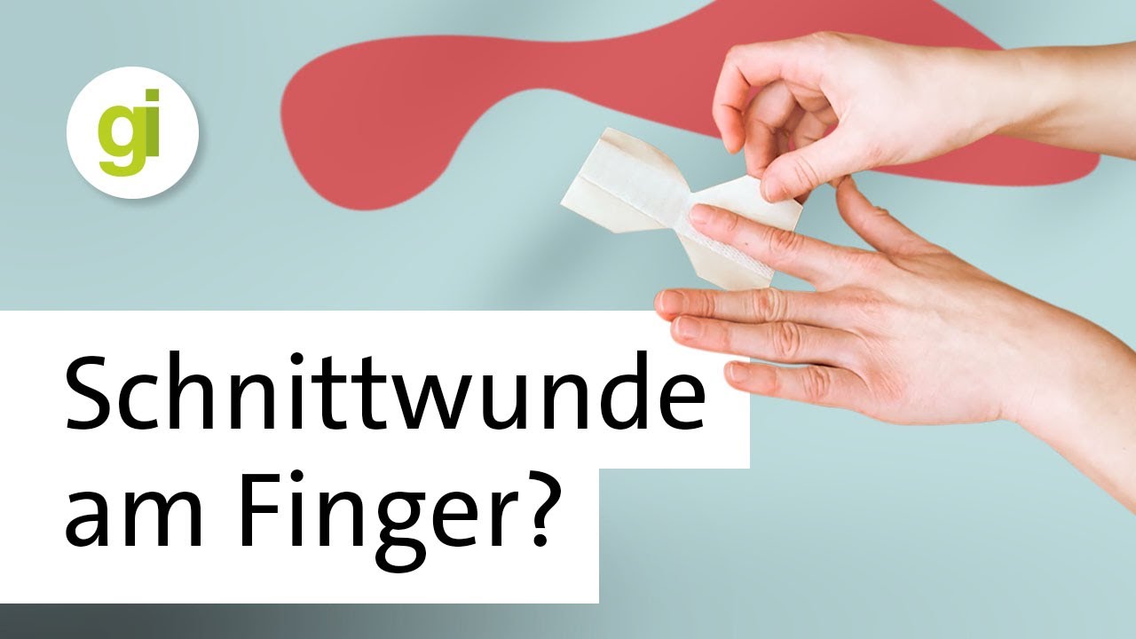 Schmetterlingsverband: So versorgst du eine Schnittwunde am Finger, ohne dass der Verband st&ouml;rt!