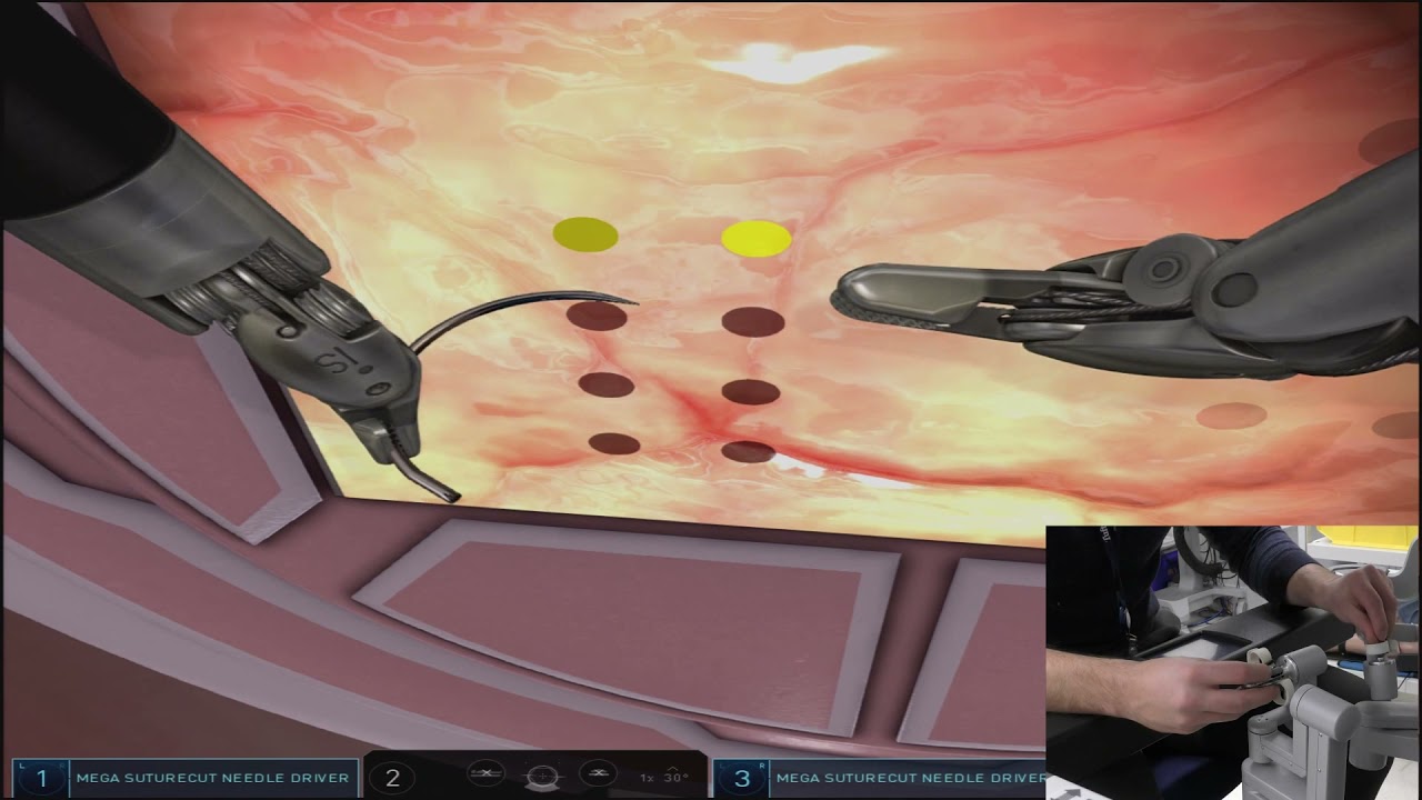 Da Vinci Skills Simulator. Robotic Sim Tips and Tricks: Anterior Needle Drive Vertical
