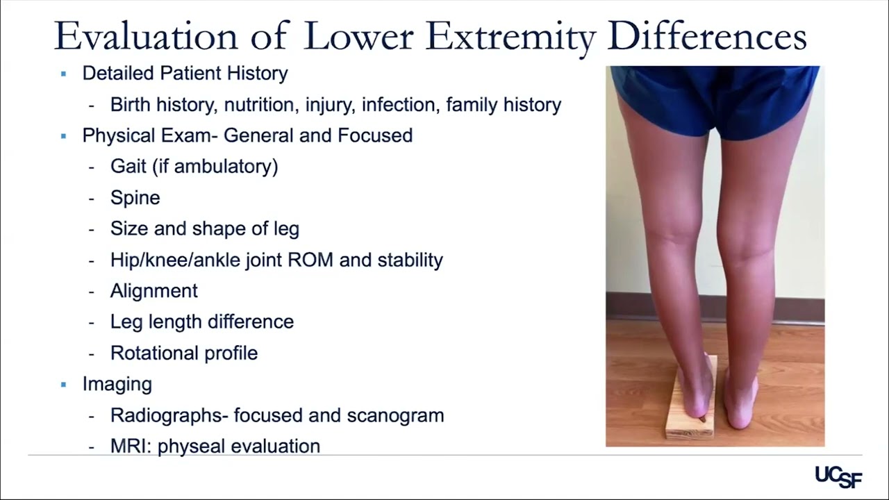 Lower Limb Differences in Children: Congenital and Non-Congenital Causes - Jaclyn F Hill, MD