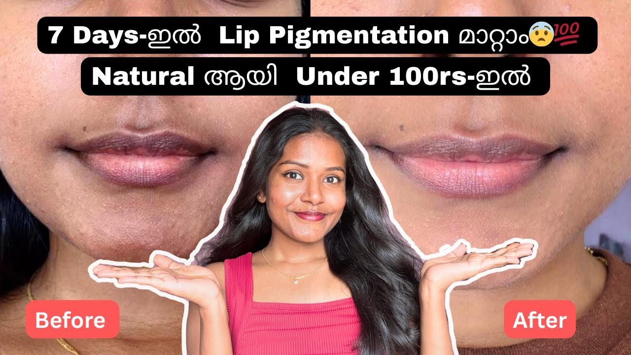 100% working 😨🙌🏻| Lets remove lip pigmentation in just 7 days😨💯