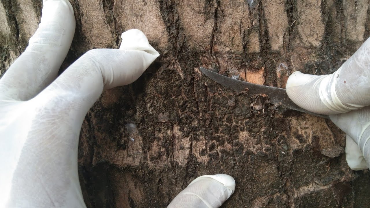 Removing Thick Scars Completely – So Satisfying to Watch