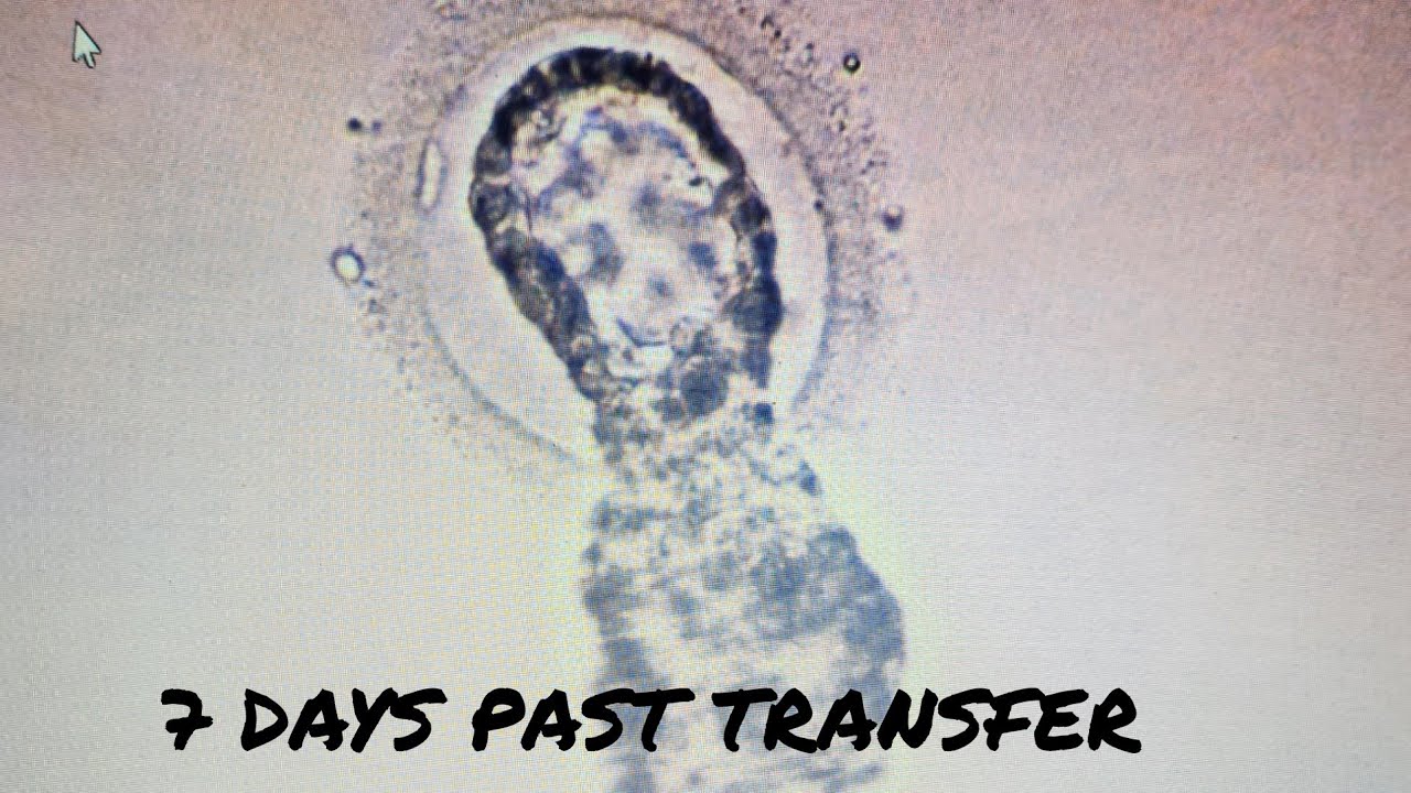 Frozen Embryo Transfer Update