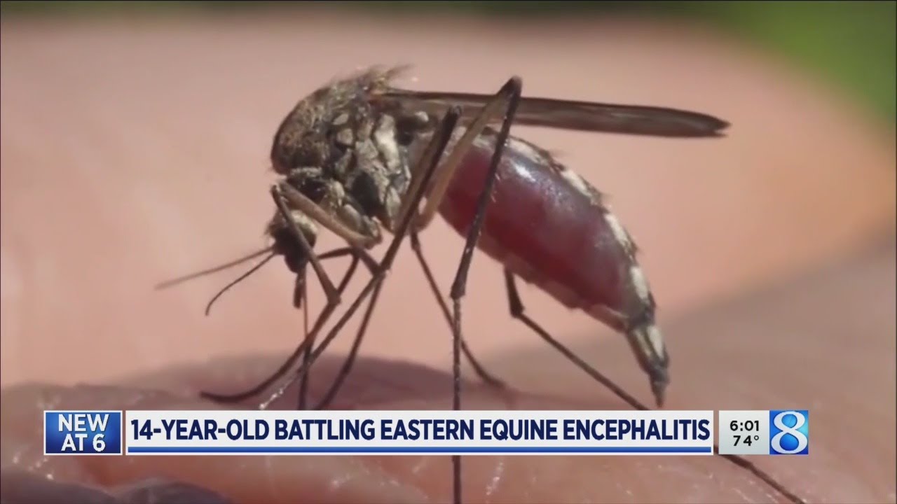 14-year-old battling Eastern Equine Encephalitis