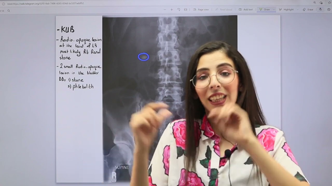 HU Radiology: Urinary system Radiology
