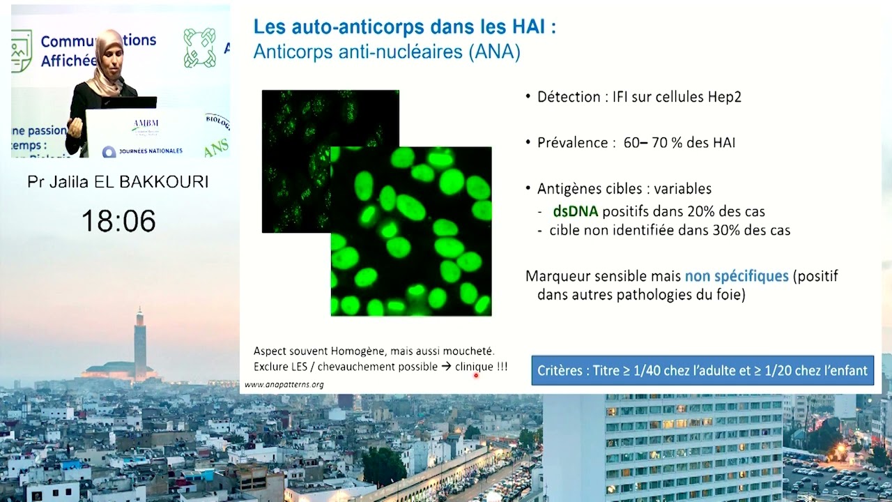Auto anticorps et pathologies hépatiques Pr Jalila EL BAKKOURI