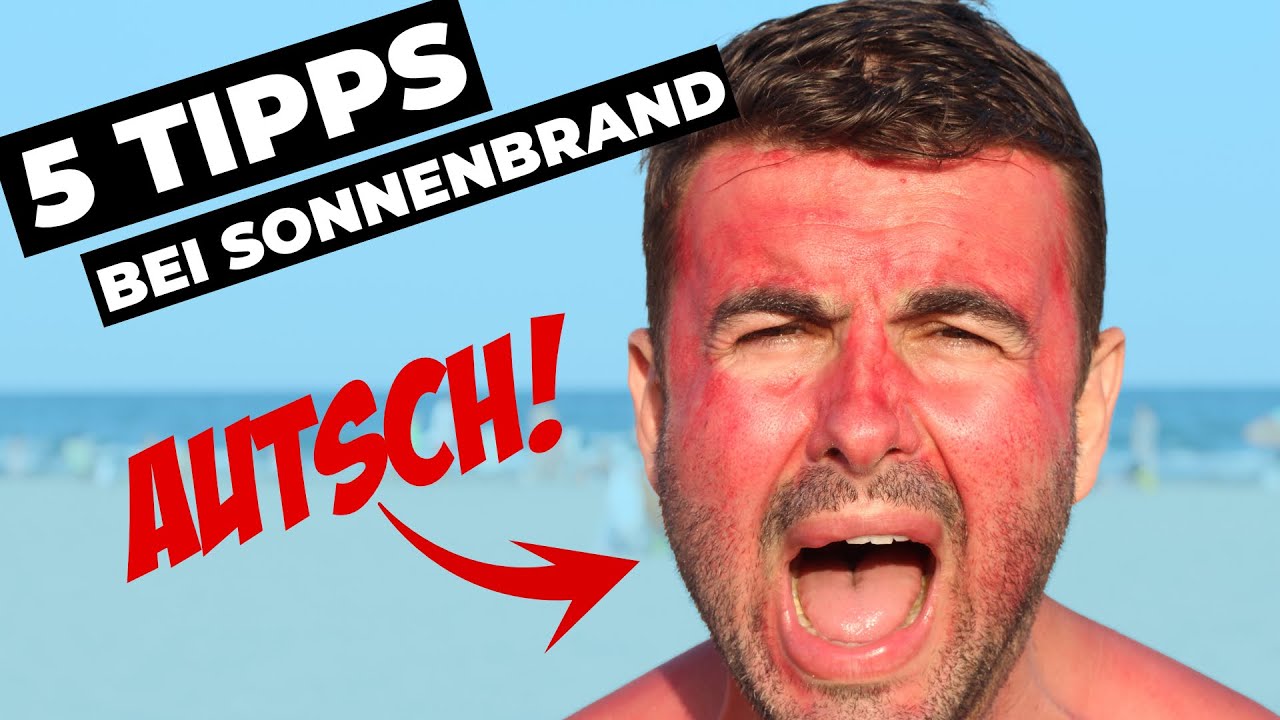 Verbrennung 2. Grades?! DAS musst DU bei Sonnenbrand sofort tun! [vermeide DIESE FEHLER!!!]