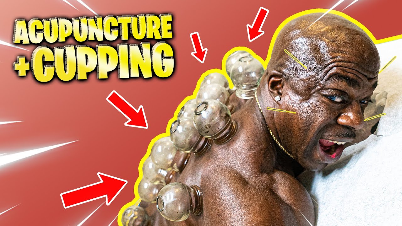 I TRIED ACUPUNCTURE - DOCTOR GIVES SECRETS TO LIVE A LONG LIFE
