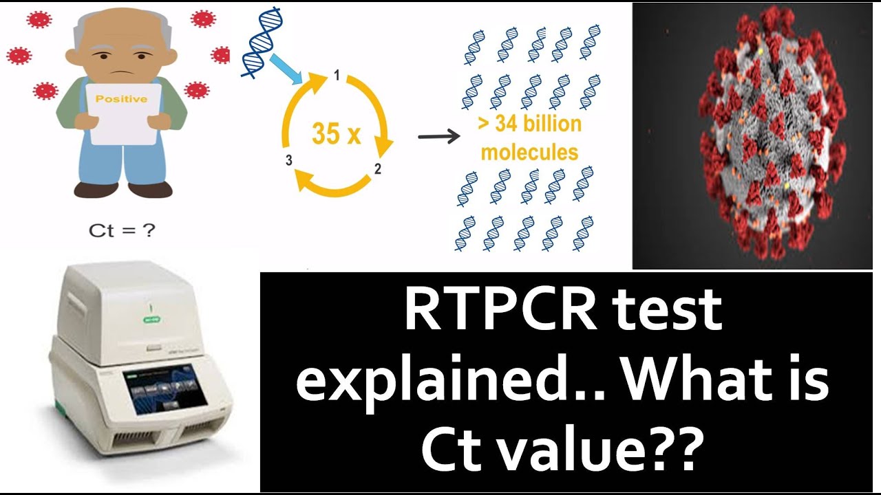 RTPCR test for COVID19 : What is Ct value