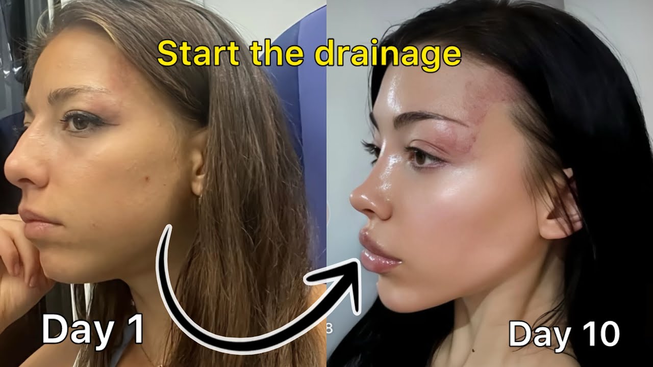 كيف تتخلص من احتباس السوائل في الوجه؟