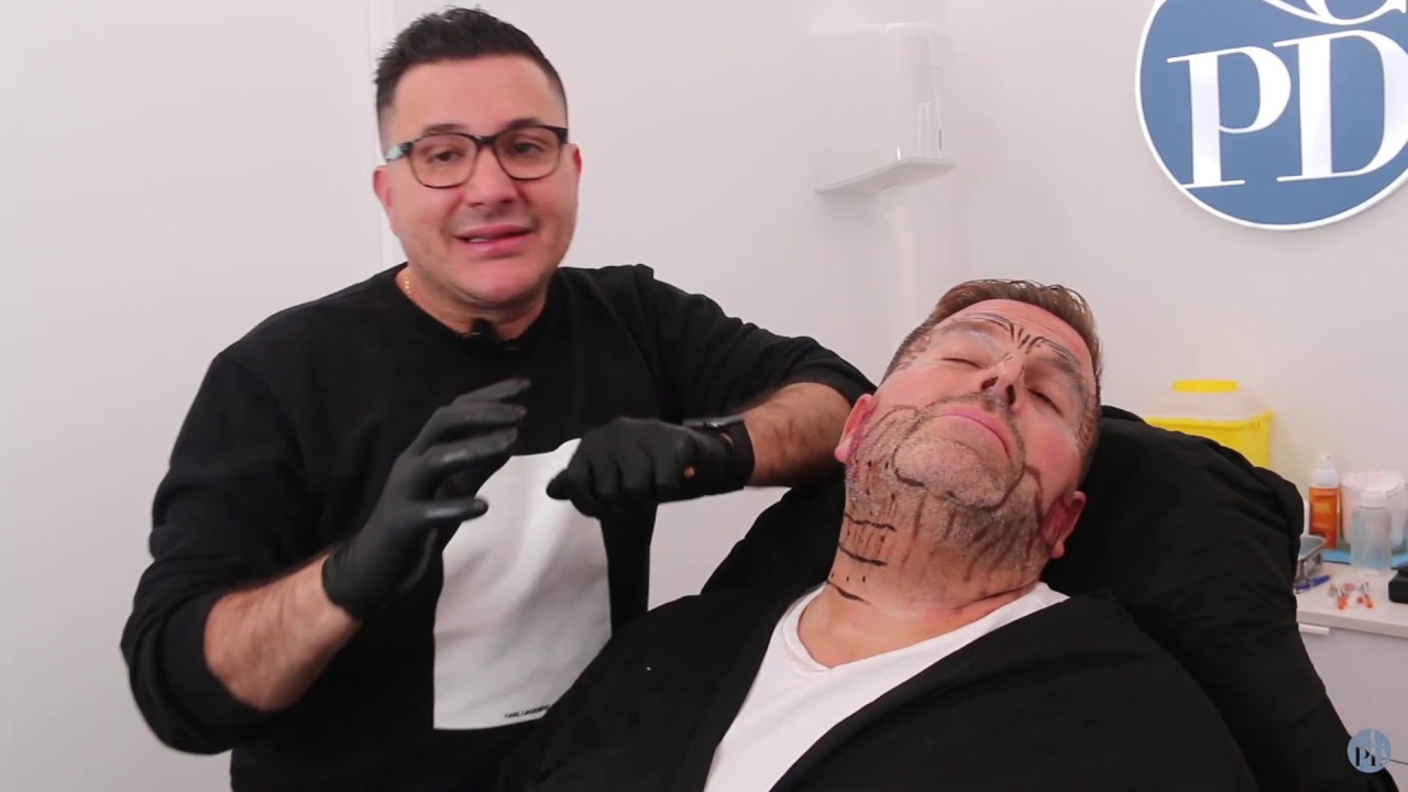 Todo lo que debes saber sobre el tratamiento botox por el Dr. Pérez Díaz