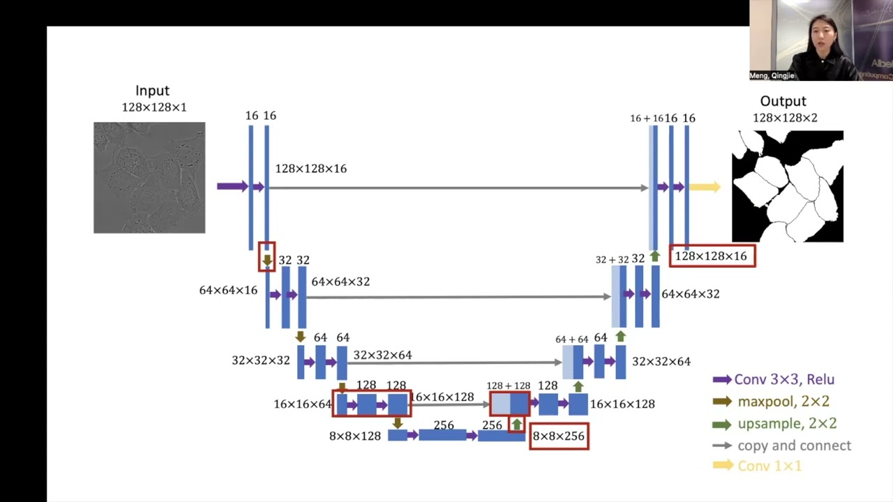 U-Net architecture