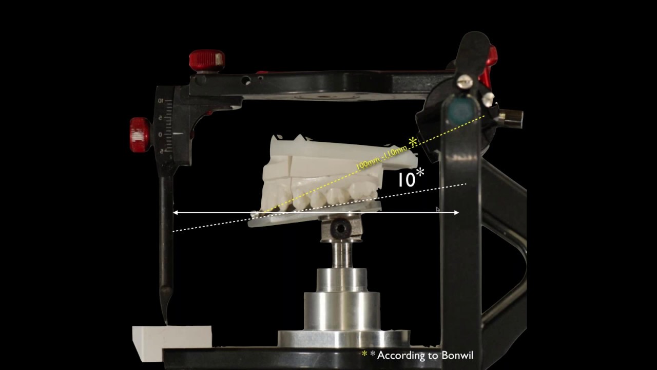 [Webinar] Functional Occlusion in the Digital Age - Part 2 with Al Fillastre, CDT