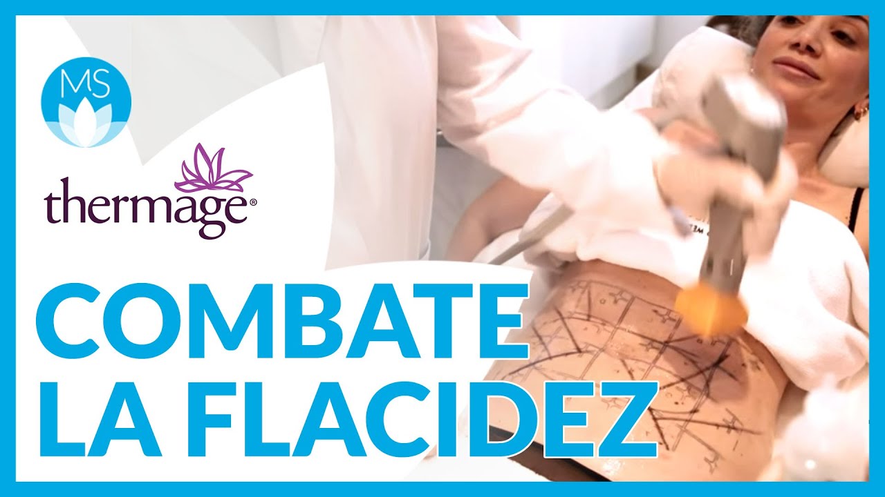 Thermage CPT Combate la flacidez en el abdomen