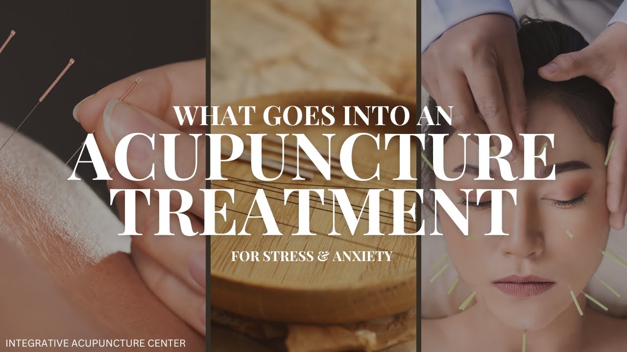 What Goes into an Acupuncture Treatment for Patients with Stress and Anxiety