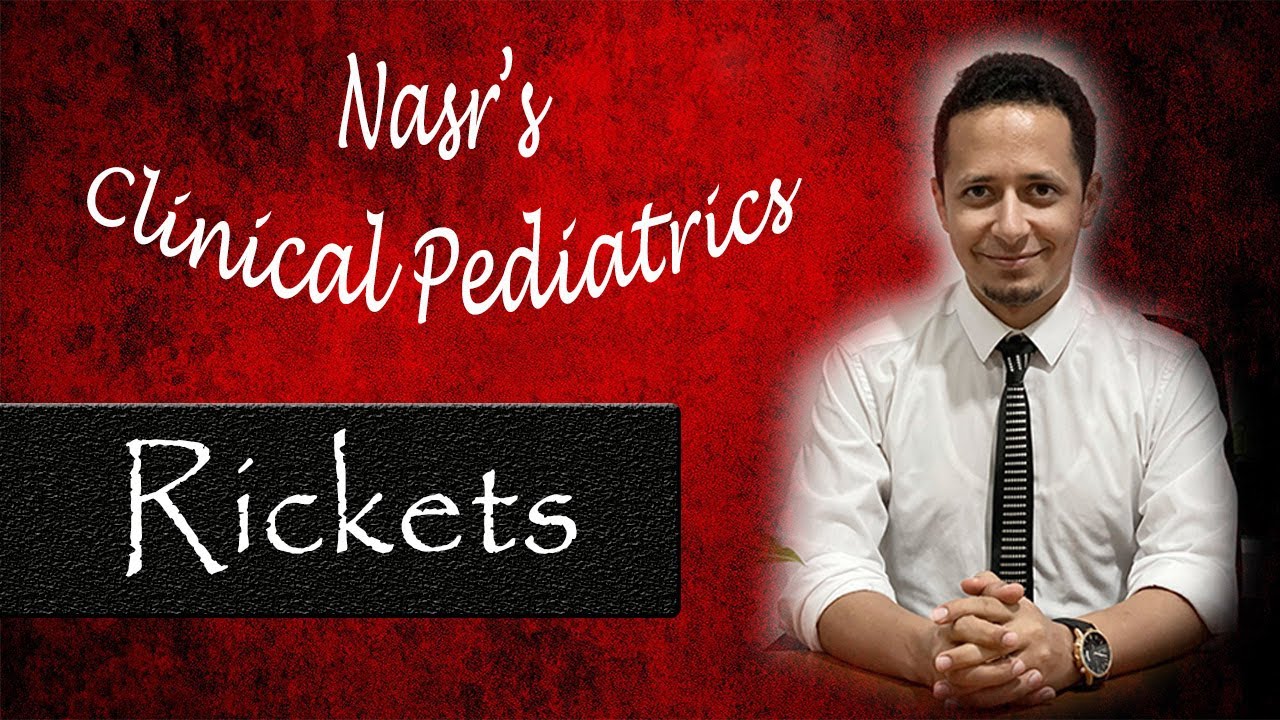 🌟New - عملي الأطفال | Clinical Pediatrics 1 | Rickets