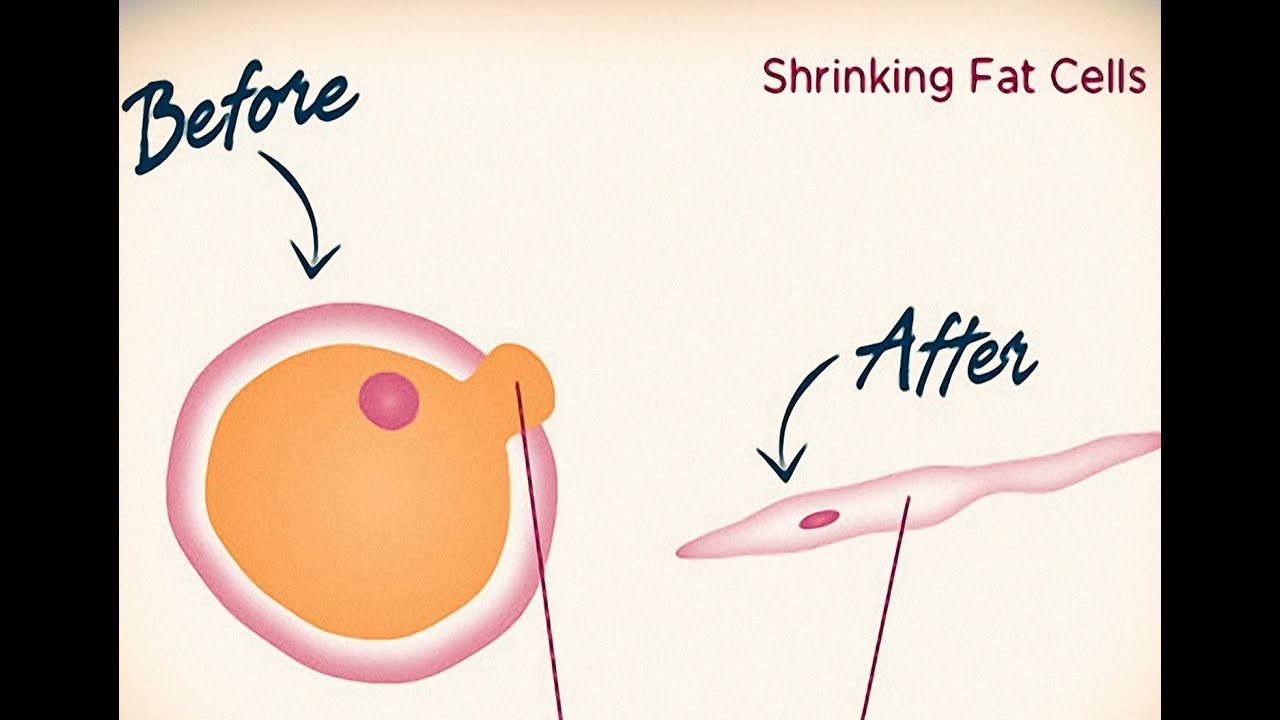 Shrink Fat Cells Now! - Subliminal - Binaural - Frequency