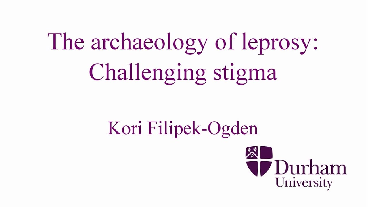 The Archaeology of Leprosy: Challenging Stigma