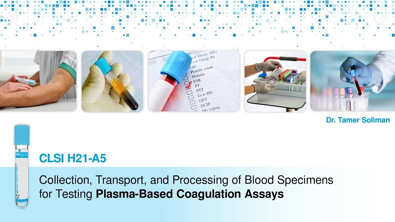 Collection, Transport, and Processing of Blood Specimens for Plasma-Based Coagulation Assays
