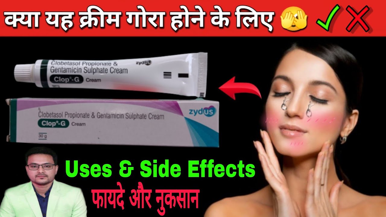 (चेहरा को गोरा करने की क्रीम✅❎)Clop ke fayde|Clop g cream uses & side effects|Clop g cream