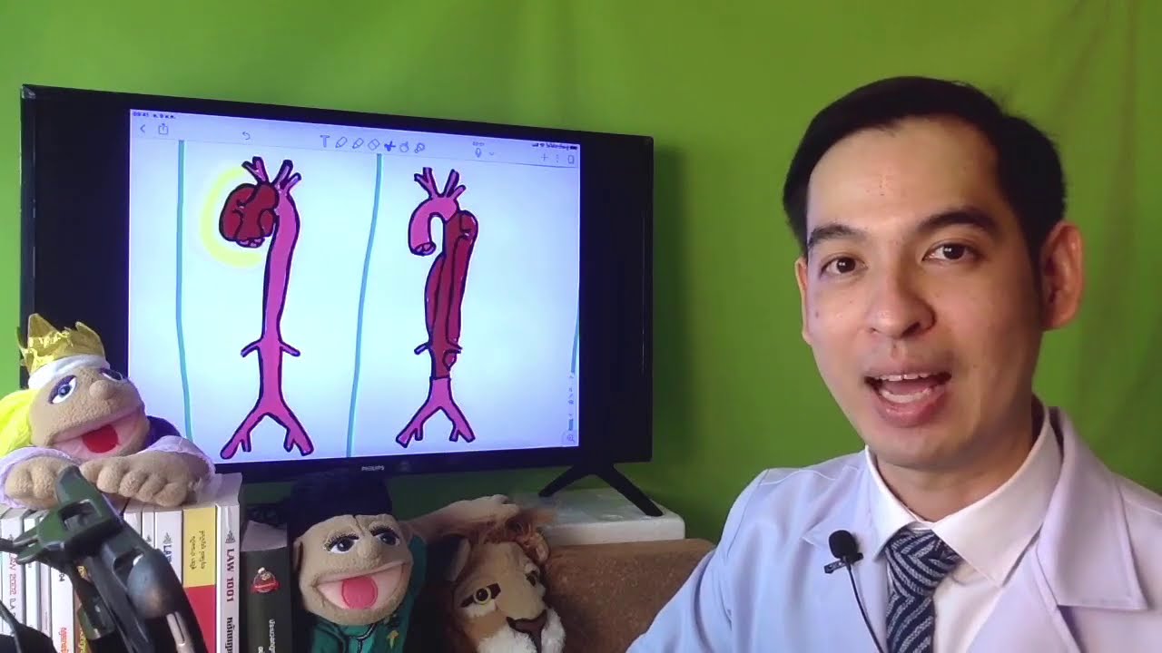 Aortic Dissection ผนังหลอดเลือดแดงใหญ่ปริแตก