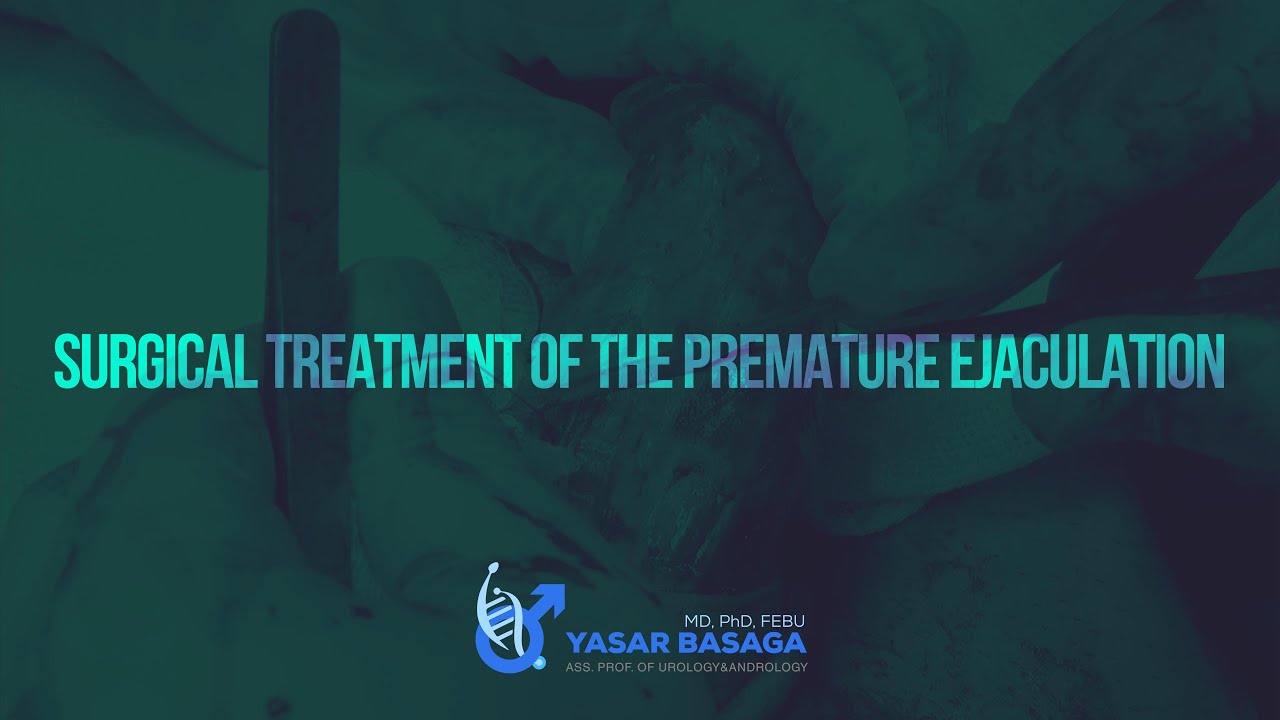 Surgical Treatment of the Premature Ejaculation