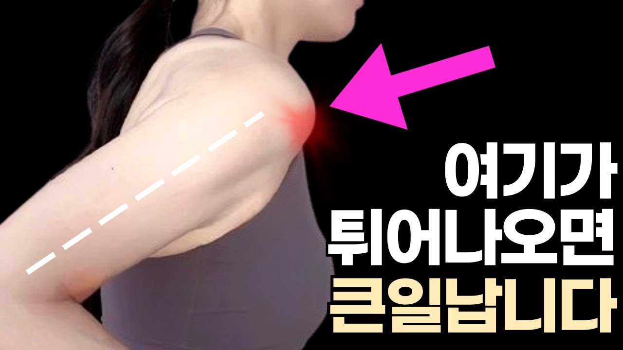 이 증상을 무시해서 관절이 망가집니다 (지금 당장 확인하세요) 상완골전방활주 교정운동