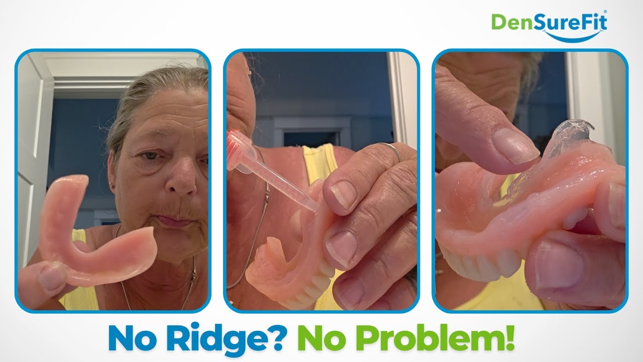 Struggling with Loose Bottom Dentures Build Wings for a Snug Fit!