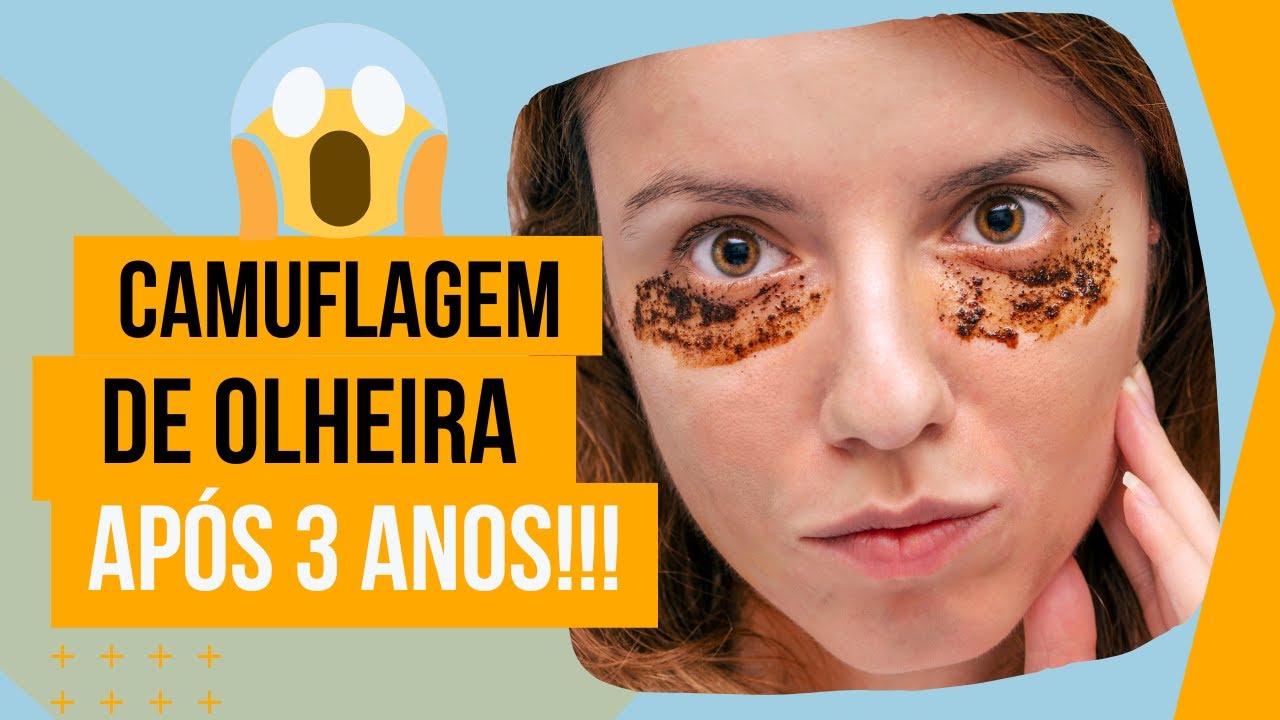 Camuflagem de Olheiras após 3 anos. Assim esta o resultado!!!