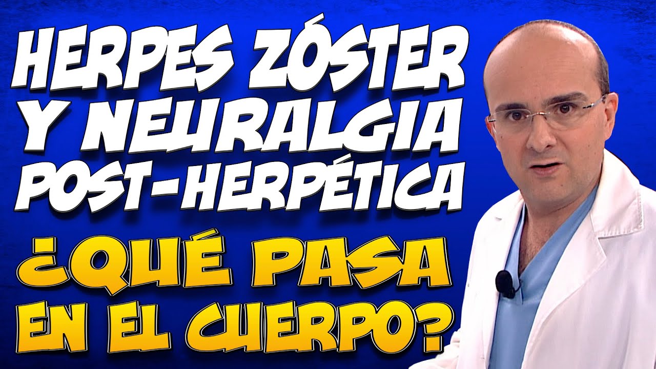 HERPES ZÓSTER Y NEURALGIA POSTHERPÉTICA - ¿Qué pasa en del cuerpo de las personas que las padecen?