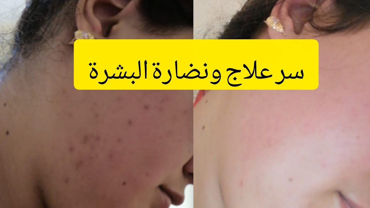اهم حاجة هیا وجهک فیطامینات وکریمات مغیقولها لیک حتی واحد 