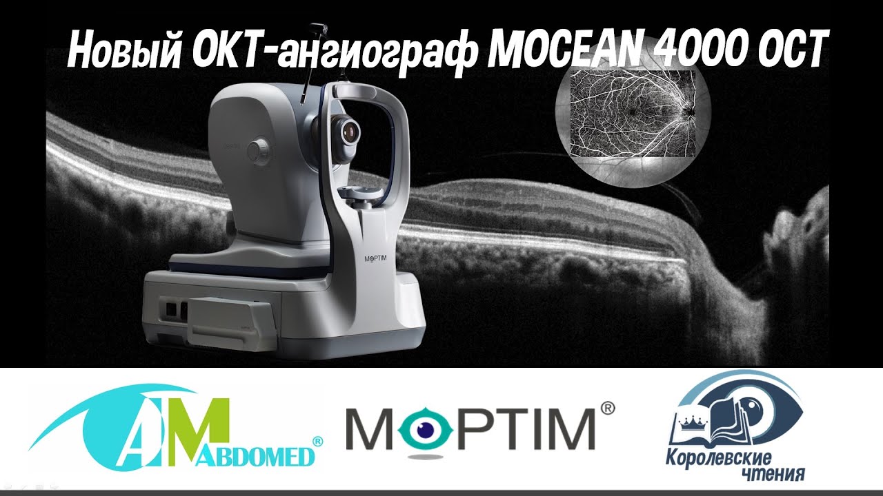 Новый ОКТ-ангиограф Mocean 4000