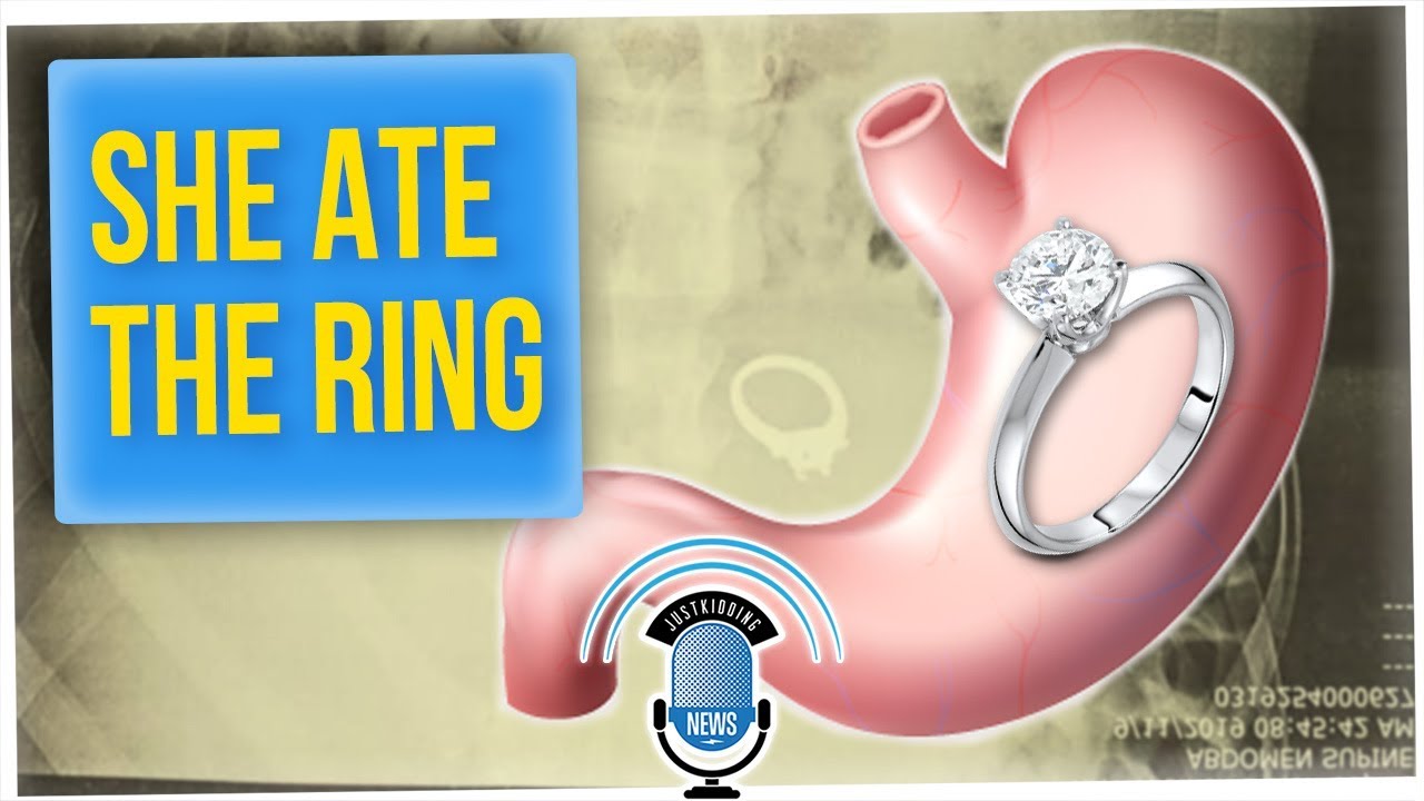 Woman Swallowed Engagement Ring in Her Sleep (ft. SUPEReeeGO)