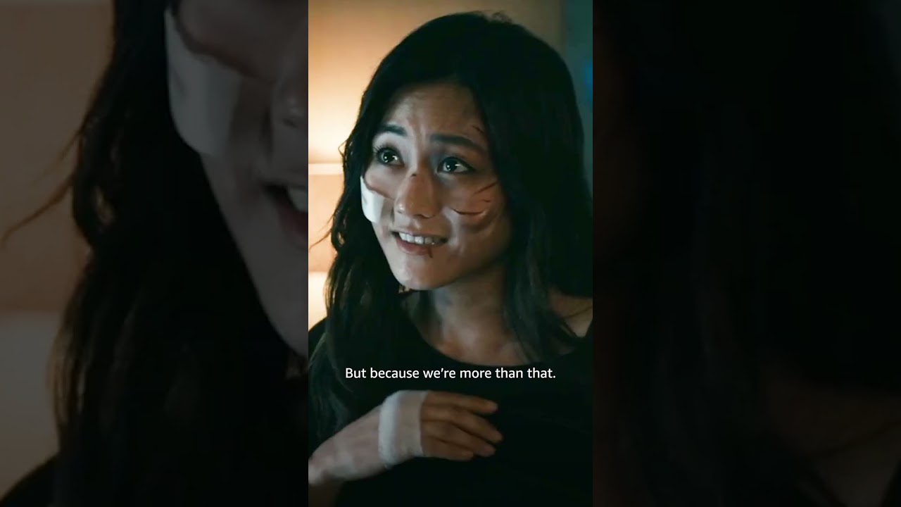That Heartbreaking Frenchie & Kimko Moment! 🥹 #Shorts