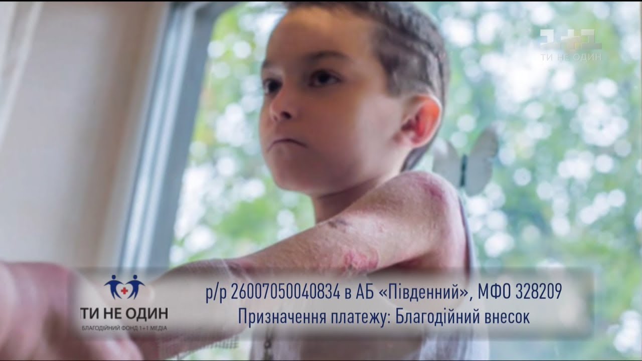 Когда поранить можно прикосновением - история мальчика-бабочки Рустама Тимошенко