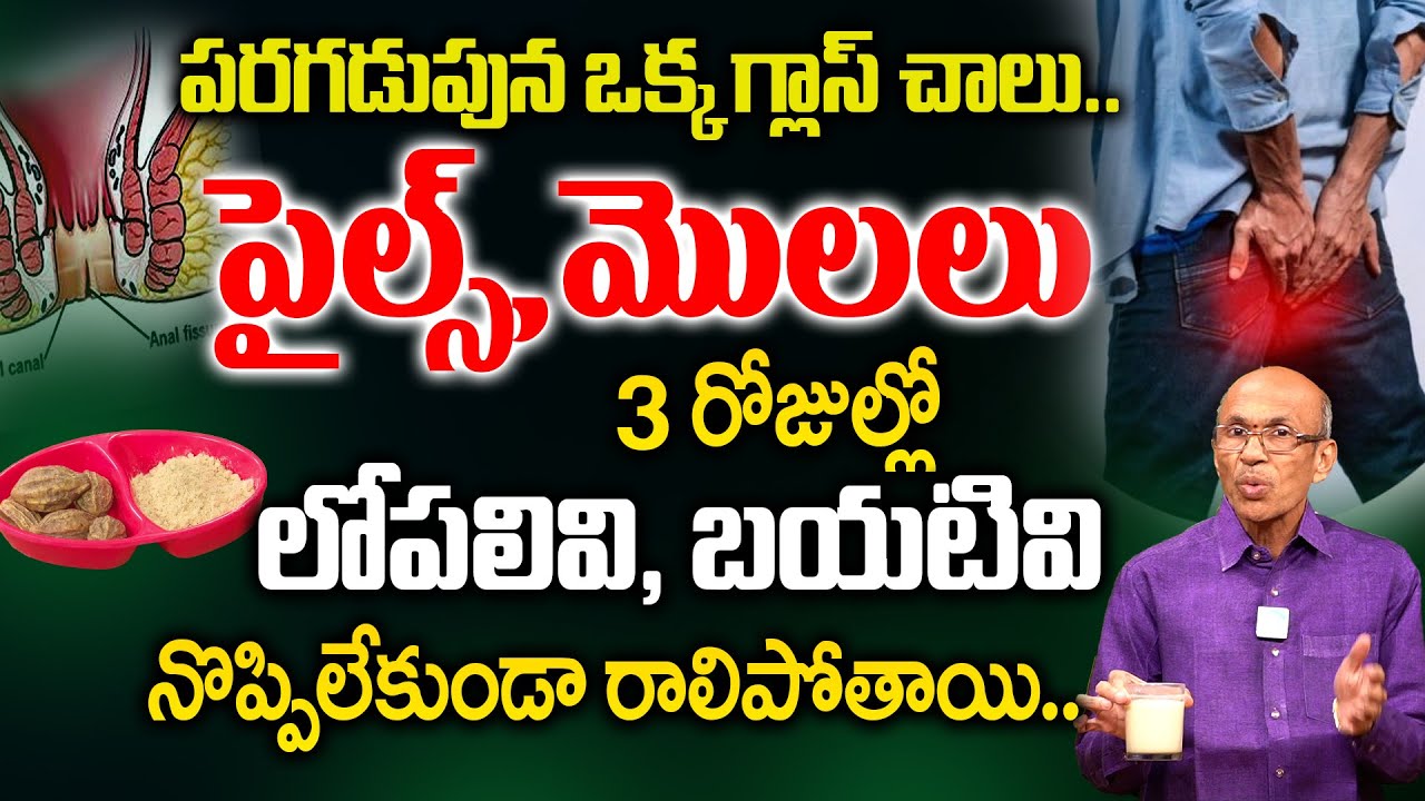 పైల్స్, మూలశంక దెబ్బకు మాయం | Piles, Moola Sanka thaggalante | Dr. Madhusudhan Sharma | iDream
