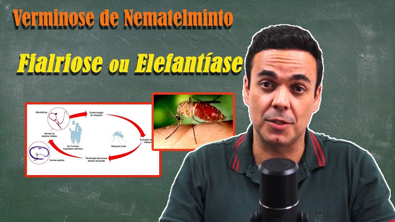 Filariose ou Elefant&iacute;ase